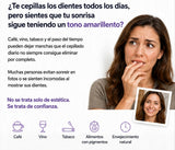 Tiras Blanqueadoras - SmileKit