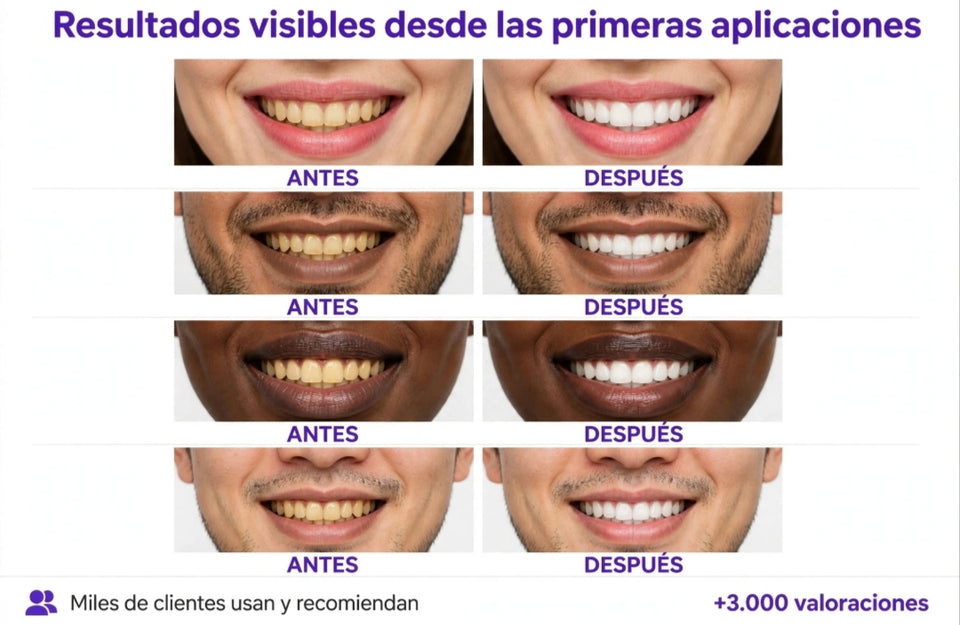 Tiras Blanqueadoras - SmileKit