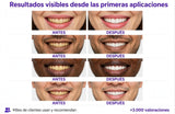 Tiras Blanqueadoras - SmileKit